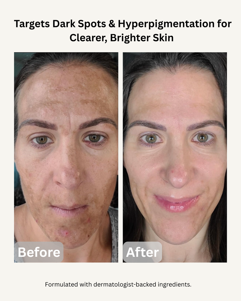 BRIGHTEN°001 - KOJIC ACID SERUM