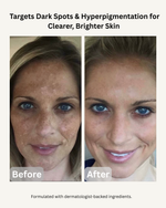 BRIGHTEN°001 - KOJIC ACID SERUM